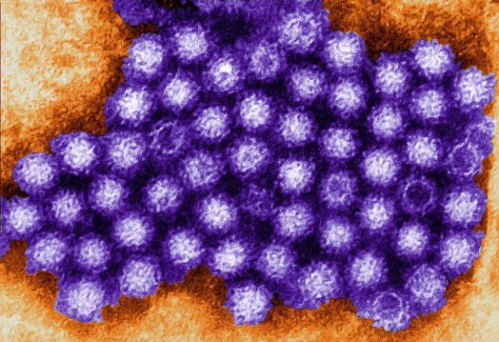 Ross Memorial clarifies outbreak restrictions